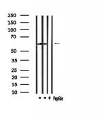 STAM2 Antibody in Western Blot (WB)