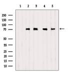 STAM2 Antibody in Western Blot (WB)