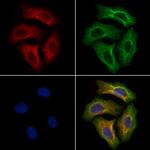 EVER2 Antibody in Immunocytochemistry (ICC/IF)