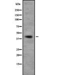 TOB1 Antibody in Western Blot (WB)