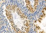 USP40 Antibody in Immunohistochemistry (Paraffin) (IHC (P))