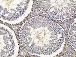 CaV2.3 Antibody in Immunohistochemistry (Paraffin) (IHC (P))