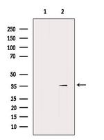 SLC30A2 Antibody in Western Blot (WB)