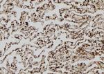 MAGEA8 Antibody in Immunohistochemistry (Paraffin) (IHC (P))