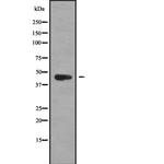 MAGEB6 Antibody in Western Blot (WB)