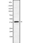 MAGEB18 Antibody in Western Blot (WB)