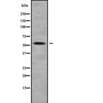 ZNF25 Antibody in Western Blot (WB)