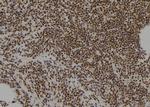 ZNF227 Antibody in Immunohistochemistry (Paraffin) (IHC (P))