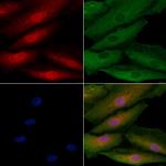 ASPM Antibody in Immunocytochemistry (ICC/IF)