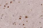 ASPM Antibody in Immunohistochemistry (Paraffin) (IHC (P))