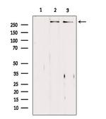 ASPM Antibody in Western Blot (WB)