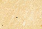 PPP1R9B Antibody in Immunohistochemistry (Paraffin) (IHC (P))