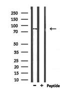 PPP1R9B Antibody in Western Blot (WB)