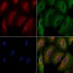 CYBA Antibody in Immunocytochemistry (ICC/IF)