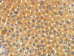 CYBA Antibody in Immunohistochemistry (Paraffin) (IHC (P))