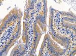 IFNLR1 Antibody in Immunohistochemistry (Paraffin) (IHC (P))