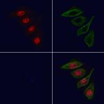 MCM8 Antibody in Immunocytochemistry (ICC/IF)