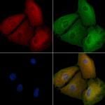 STRN Antibody in Immunocytochemistry (ICC/IF)