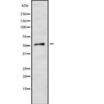 CYP2A6/CYP2A7/CYP2A13 Antibody in Western Blot (WB)