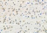 TXK Antibody in Immunohistochemistry (Paraffin) (IHC (P))