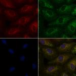 TAS2R9 Antibody in Immunocytochemistry (ICC/IF)