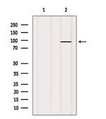 TAS1R2 Antibody in Western Blot (WB)