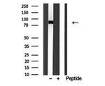 IFT88 Antibody in Western Blot (WB)