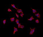 VPRBP Antibody in Immunocytochemistry (ICC/IF)