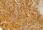 VPRBP Antibody in Immunohistochemistry (Paraffin) (IHC (P))