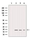 IFT20 Antibody in Western Blot (WB)