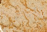 SMCR7L Antibody in Immunohistochemistry (Paraffin) (IHC (P))