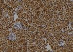 FIP200 Antibody in Immunohistochemistry (Paraffin) (IHC (P))