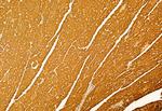 FIP200 Antibody in Immunohistochemistry (Paraffin) (IHC (P))