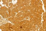 FIP200 Antibody in Immunohistochemistry (Paraffin) (IHC (P))