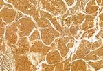 FIP200 Antibody in Immunohistochemistry (Paraffin) (IHC (P))