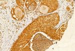 FIP200 Antibody in Immunohistochemistry (Paraffin) (IHC (P))