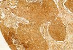 FIP200 Antibody in Immunohistochemistry (Paraffin) (IHC (P))