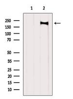 FIP200 Antibody in Western Blot (WB)