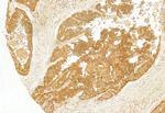 MKS1 Antibody in Immunohistochemistry (Paraffin) (IHC (P))