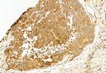 MKS1 Antibody in Immunohistochemistry (Paraffin) (IHC (P))