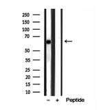 MKS1 Antibody in Western Blot (WB)