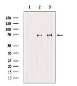 MKS1 Antibody in Western Blot (WB)