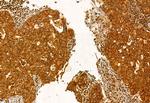 Pallidin Antibody in Immunohistochemistry (Paraffin) (IHC (P))