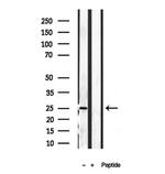 Pallidin Antibody in Western Blot (WB)