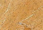 PYCR1 Antibody in Immunohistochemistry (Paraffin) (IHC (P))