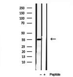 PYCR1 Antibody in Western Blot (WB)