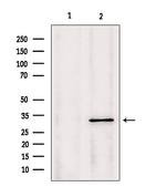 PYCR1 Antibody in Western Blot (WB)