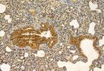 MPP5 Antibody in Immunohistochemistry (Paraffin) (IHC (P))