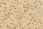 UBAP1 Antibody in Immunohistochemistry (Paraffin) (IHC (P))