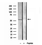 UBAP1 Antibody in Western Blot (WB)